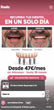 El mismo anuncio de CEM Valderas adaptado a reels, con el antes y el después y el botón para pedir valoración
