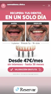 Anuncio de CEM Valderas en historias de Instagram: «Recupera tus dientes en un solo día», con fotos de antes y después de una sonrisa